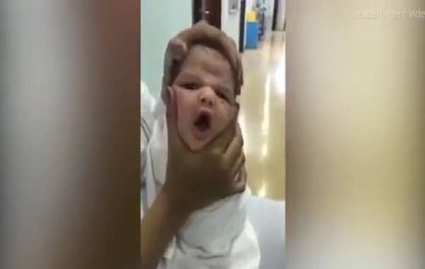 3 y tá bị đuổi việc sau khi đăng clip 'bóp mặt' trẻ sơ sinh