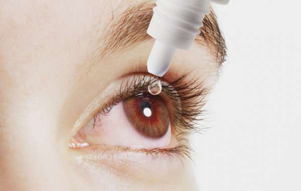 Viêm giác mạc sợi -  bệnh lý mắt thường gặp
